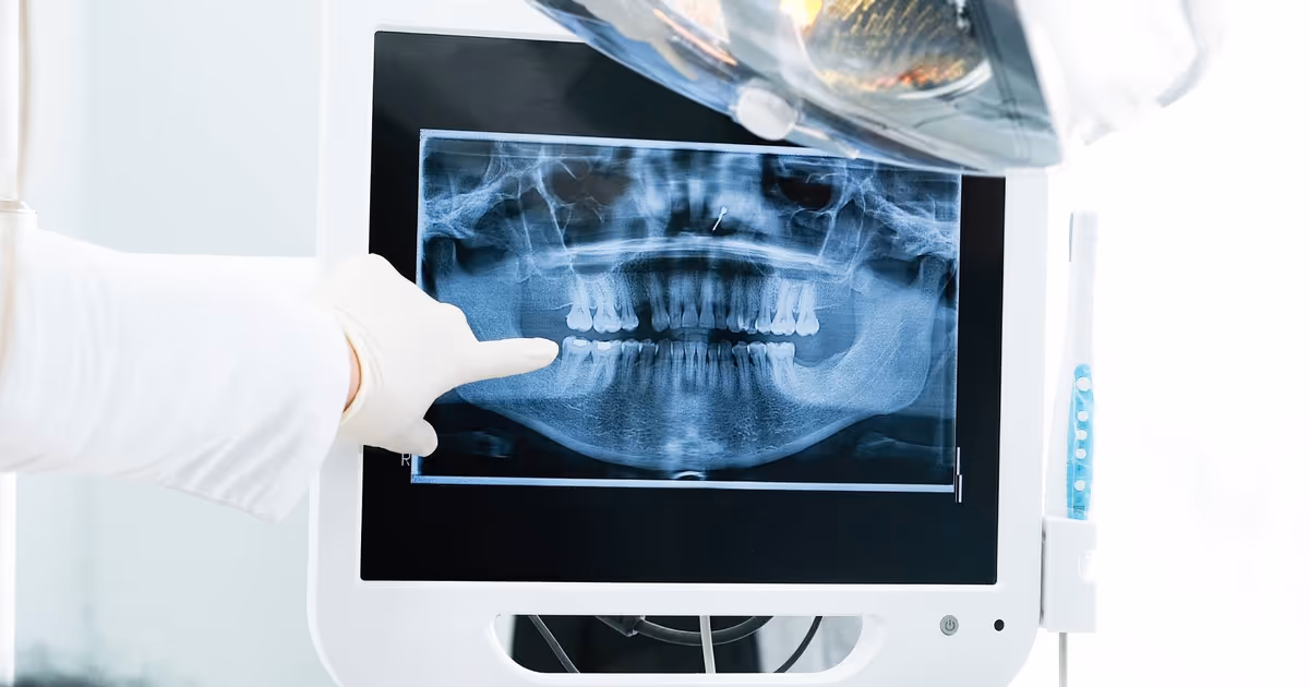 Deadline fast approaching to renew Canadian Dental Care Plan coverage