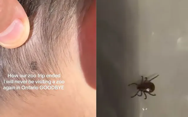 ‘A small bug can change your life’: Why one Ontario mom is warning parents after child’s ‘nerve-racking’ tick scare