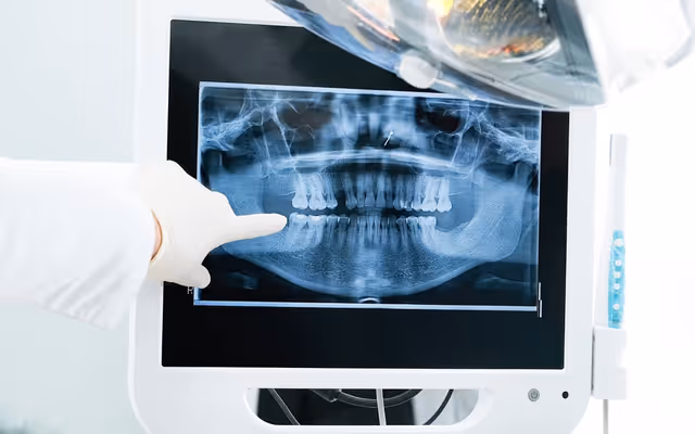 Deadline fast approaching to renew Canadian Dental Care Plan coverage