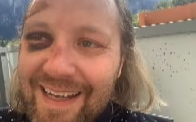 B.C. man lost for 5 nights in mountains near Squamish shares survival story